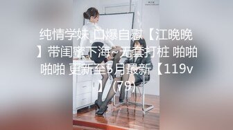 MKY-NS-002痴呆病人捆绑礼物-李蓉蓉